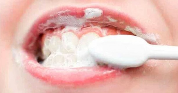 Foto - Birçok kişi farkında değil! Dişler karbonat ile fırçalandığında bakın ne oluyor