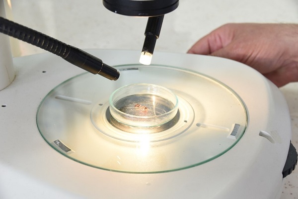 Foto - Birçok kişinin korkulu rüyası | İşte tehlikeli kenelerin en çok görüldüğü iller