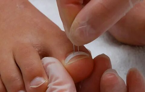 Foto - Birçok kişinin başına geliyor İşte tırnak batmasını önlemenin 5 yolu!