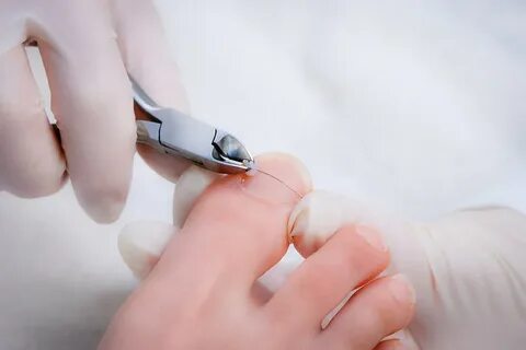 Foto - Birçok kişinin başına geliyor İşte tırnak batmasını önlemenin 5 yolu!