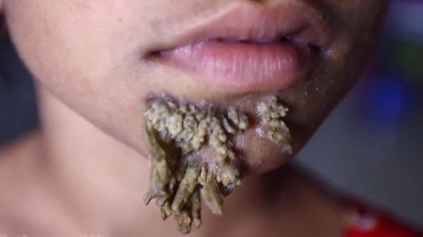 Foto - Birden yüzünde çıkmaya başladılar!