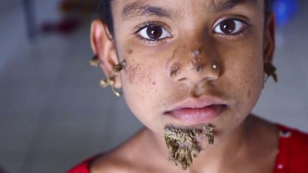 Foto - Birden yüzünde çıkmaya başladılar!