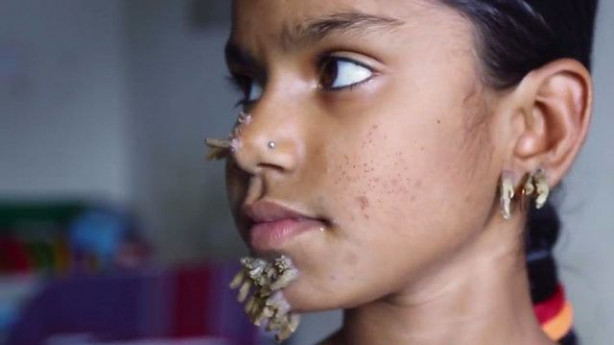 Foto - Birden yüzünde çıkmaya başladılar!