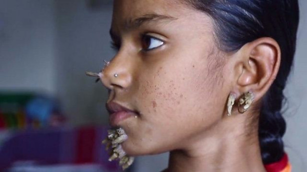 Foto - Birden yüzünde çıkmaya başladılar!