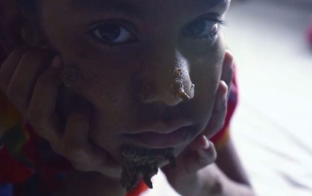 Foto - Birden yüzünde çıkmaya başladılar!