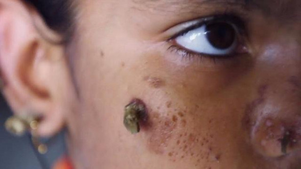 Foto - Birden yüzünde çıkmaya başladılar!