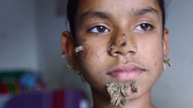 Foto - Birden yüzünde çıkmaya başladılar!