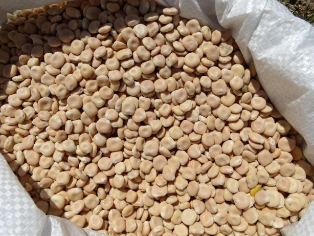 Foto - Böbrek sağlığına iyi gelen içecek ve besinler