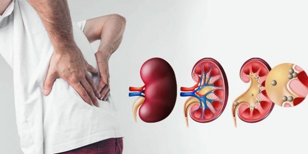 Foto - Böbrek sağlığını koruyan 12 gıda