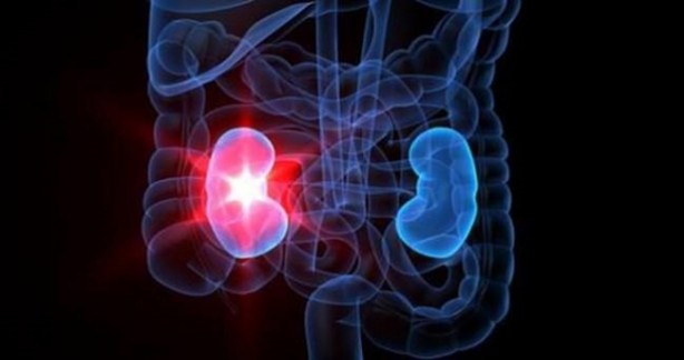 Foto - Böbrek sancısı çekmek istemiyorsanız...