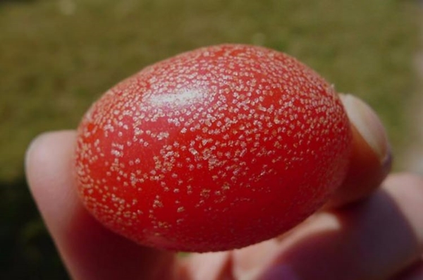 Foto - Böbrek şikayetleri olanlar, dikkat!