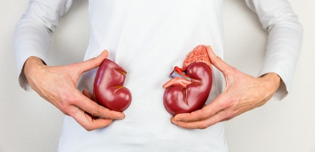 Foto - Böbrek taşı olanlar dikkat! Kesinlikle bunu ihmal etmeyin