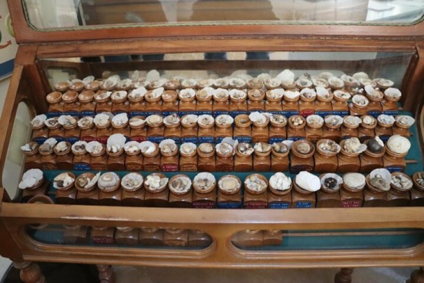 Foto - Böbreklerden çıkan taşlar görenleri hayrete düşürüyor!