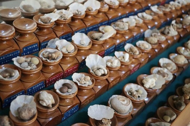 Foto - Böbreklerden çıkan taşlar görenleri hayrete düşürüyor!