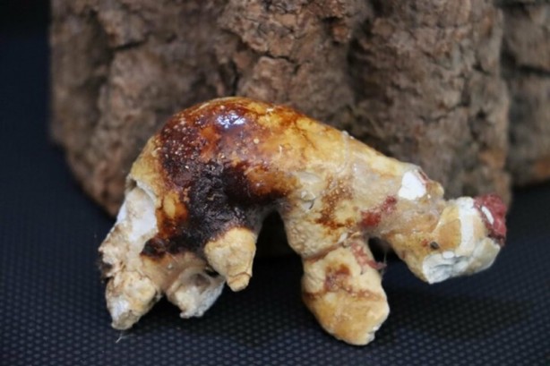 Foto - Böbreklerden çıkan taşlar görenleri hayrete düşürüyor!