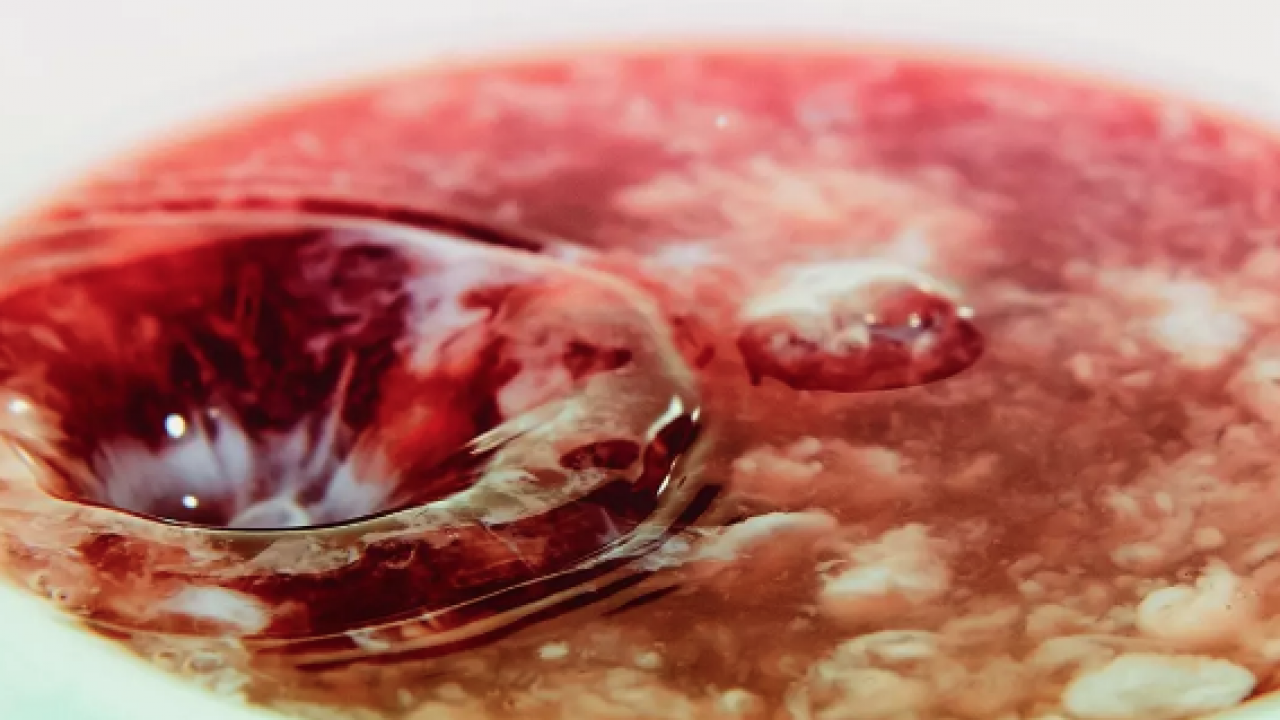 Böbrekleri çökertiyor: Meğer taş yapıyormuş! Sağlıklı diye bardak bardak içiyoruz: