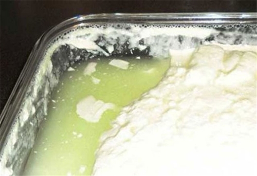 Foto - Böbreklerdeki taşı temizliyor!