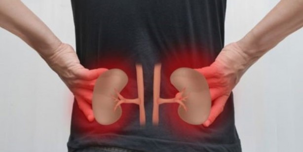 Foto - Böbreklerinizi kaybetmek istemiyorsanız bu belirtilere dikkat edin