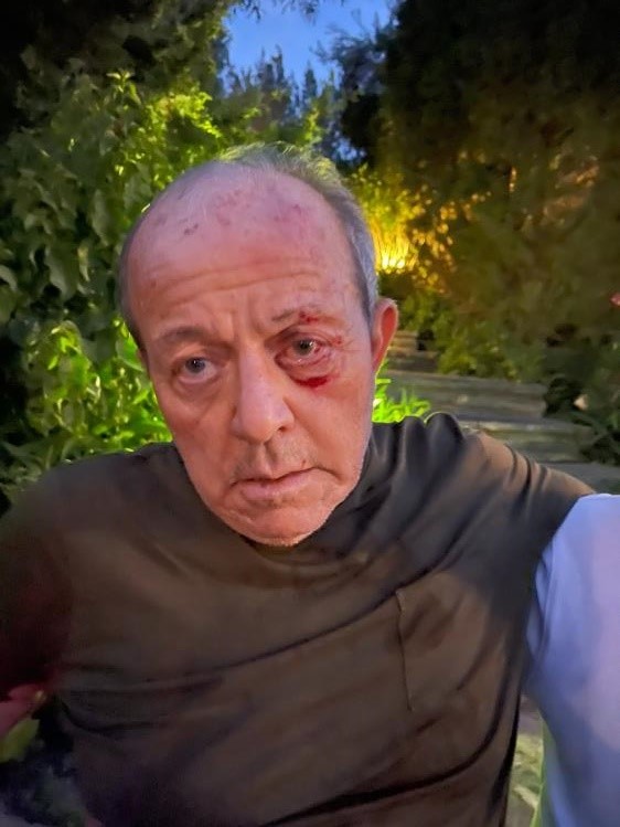 Foto - Bodrum'da ünlü iş adamı Kaya Sabancı uğradığı fiziki saldırı sonucu hastanelik oldu