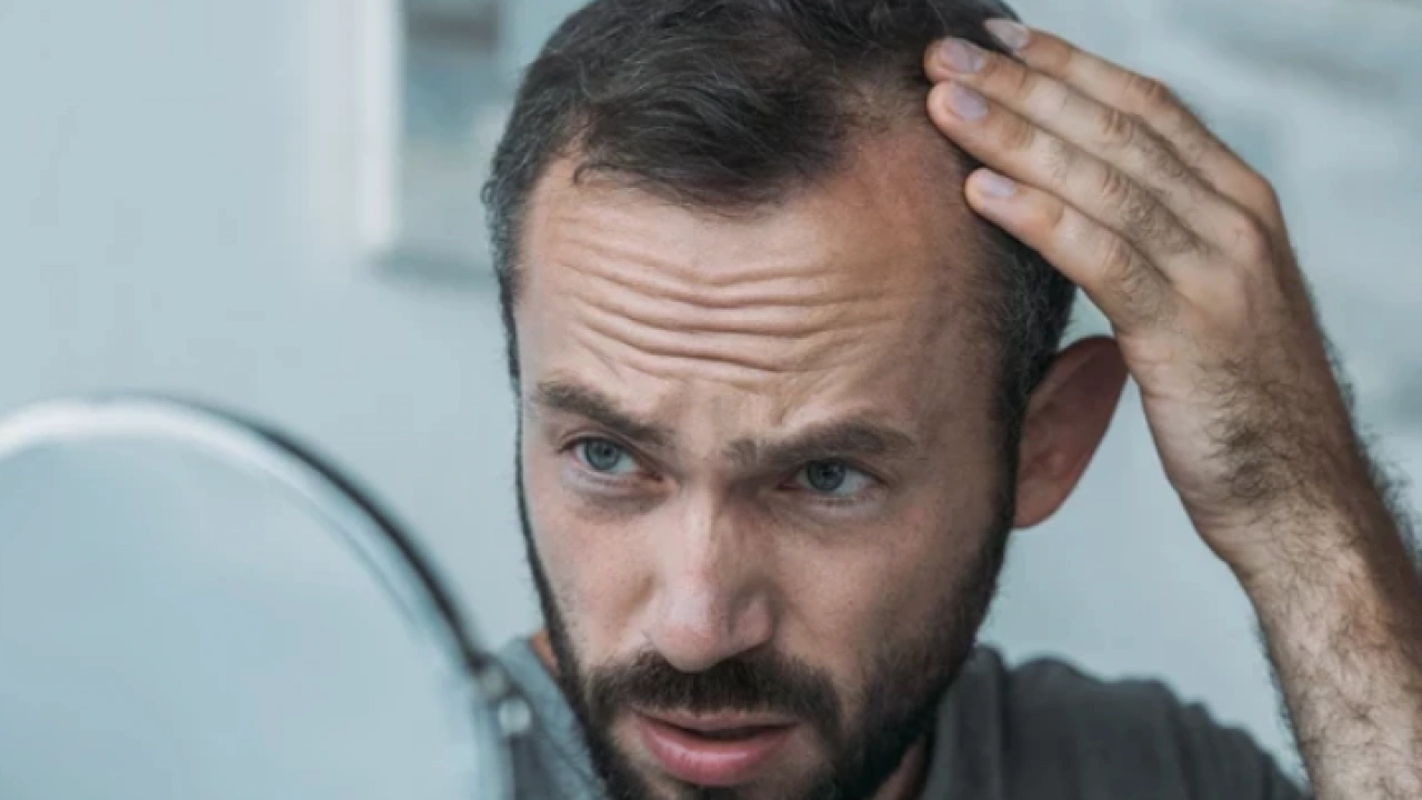 Foto - Bölgesel kellik diyabetin habercisi mi? Kellik deyip geçmemek lazım yoksa…