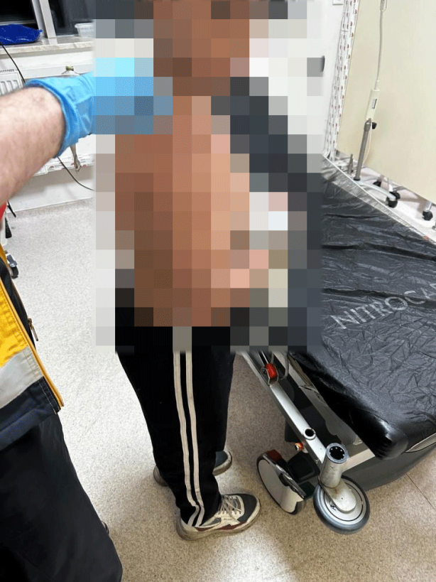 Foto - Böyle skandal görülmedi! CHP'nin seçim bürosunda çocuğa kaynar su işkencesi