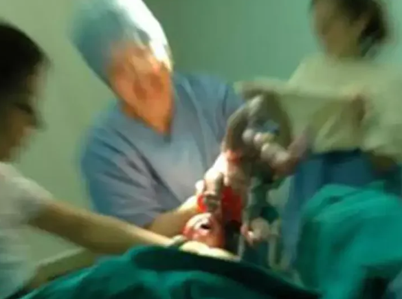 Foto - Böyle skandal görülmedi! Dünya bu olayı konuşuyor… Doktor doğum sırasında bebeğin kafasını kopardı
