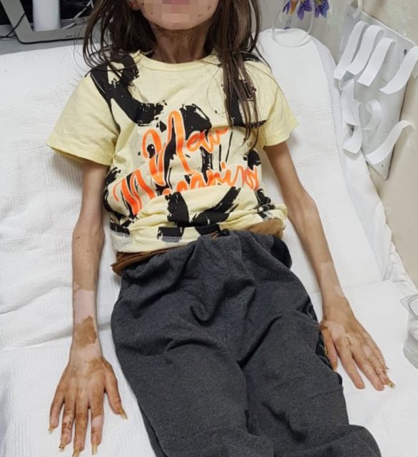 Foto - Böyle teyze olmaz olsun! Çöp evde alıkonulan Muhammet'in ifadesi ortaya çıktı