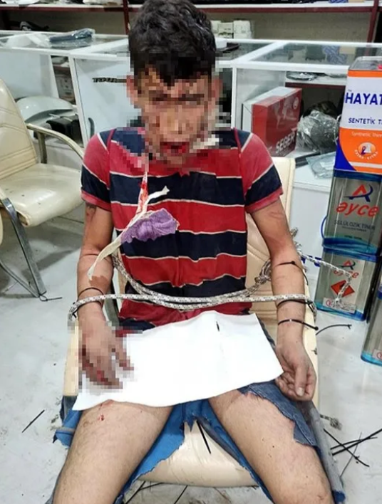 Foto - Böyle vahşet görülmedi! 3 gün işkence gördü! Böcek yedirildi! Her şey delilli ispatlı ama… 