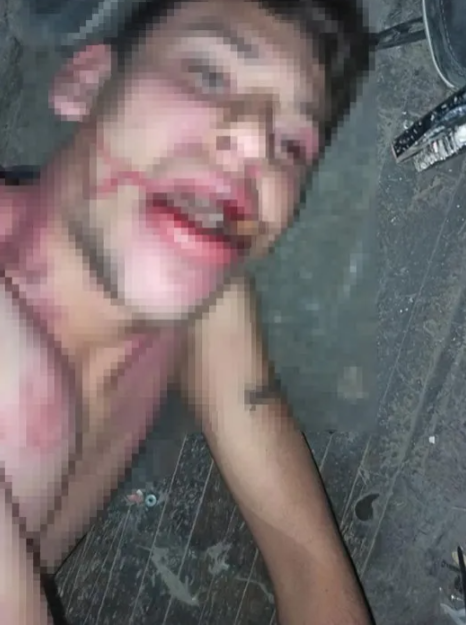 Foto - Böyle vahşet görülmedi! 3 gün işkence gördü! Böcek yedirildi! Her şey delilli ispatlı ama… 