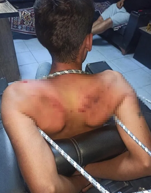 Foto - Böyle vahşet görülmedi! 3 gün işkence gördü! Böcek yedirildi! Her şey delilli ispatlı ama… 