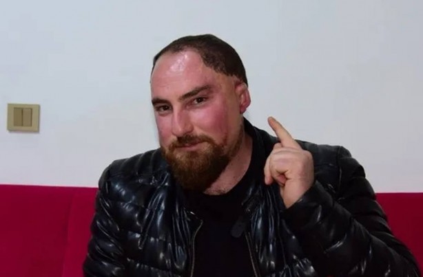 Böylesi ancak filmlerde olur sanıyorduk: Pişmiş tavuk bile bu adamdan daha şanslı! Senin ağzın ne söylüyor böyle Alparslan kardeş