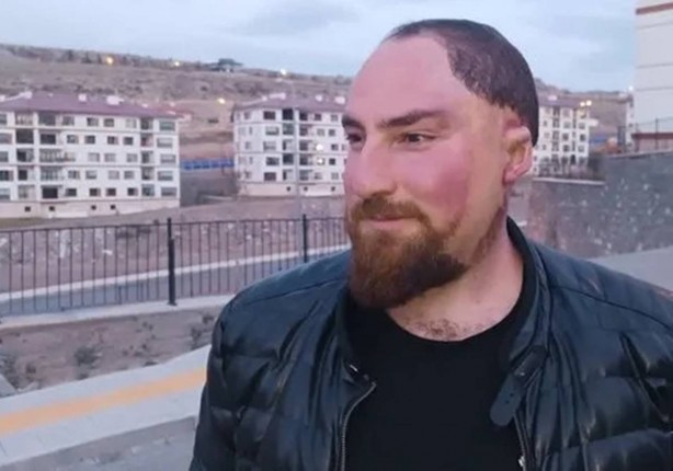 Foto - Böylesi ancak filmlerde olur sanıyorduk: Pişmiş tavuk bile bu adamdan daha şanslı! Senin ağzın ne söylüyor böyle Alparslan kardeş