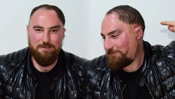 Foto - Böylesi ancak filmlerde olur sanıyorduk: Pişmiş tavuk bile bu adamdan daha şanslı! Senin ağzın ne söylüyor böyle Alparslan kardeş