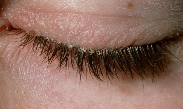 Foto - Böylesi duyulmadı! İşte insan vücudunun ilginç özellikleri...