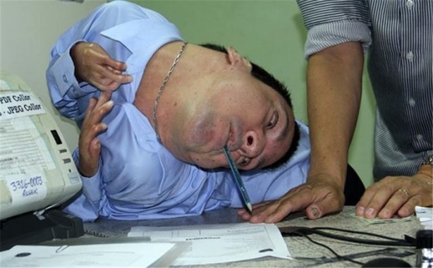 Foto - Boynu ters doğan Oliveira 40 yaşında