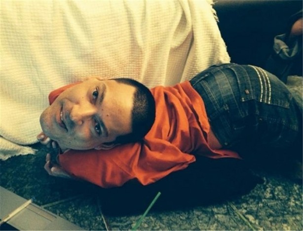 Foto - Boynu ters doğan Oliveira 40 yaşında