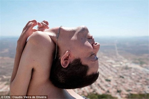 Foto - Boynu ters doğan Oliveira 40 yaşında