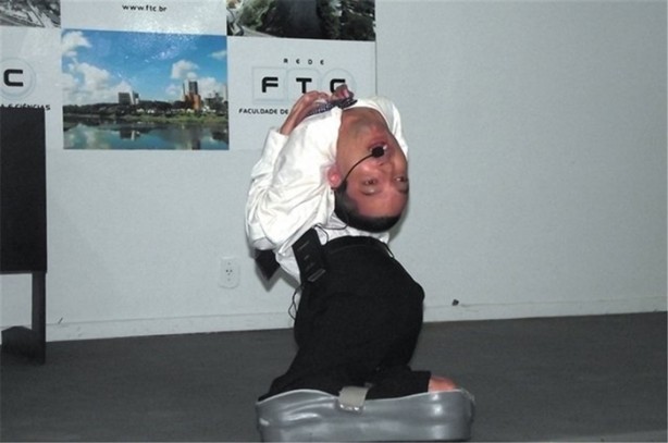 Foto - Boynu ters doğan Oliveira 40 yaşında