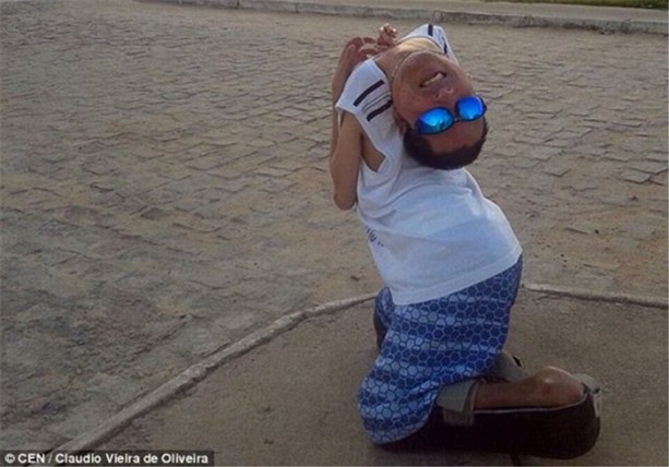 Boynu ters doğan Oliveira 40 yaşında