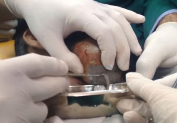 Foto - Boynundaki kitleye neşteri vurunca gözlerine inanamadılar!