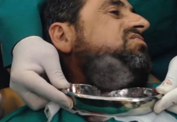 Foto - Boynundaki kitleye neşteri vurunca gözlerine inanamadılar!