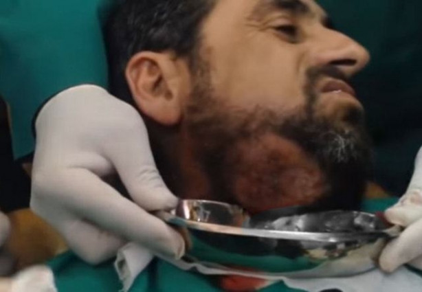 Foto - Boynundaki kitleye neşteri vurunca gözlerine inanamadılar!