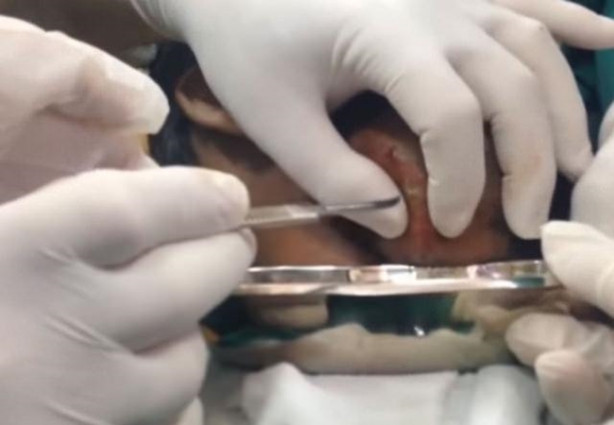 Foto - Boynundaki kitleye neşteri vurunca gözlerine inanamadılar!