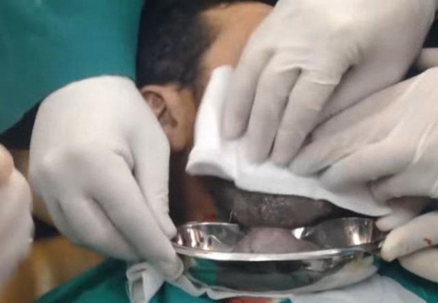 Foto - Boynundaki kitleye neşteri vurunca gözlerine inanamadılar!