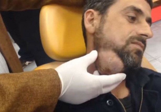 Foto - Boynundaki kitleye neşteri vurunca gözlerine inanamadılar!