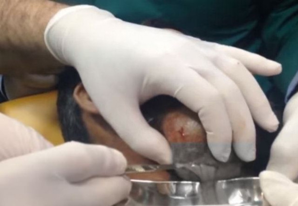 Foto - Boynundaki kitleye neşteri vurunca gözlerine inanamadılar!