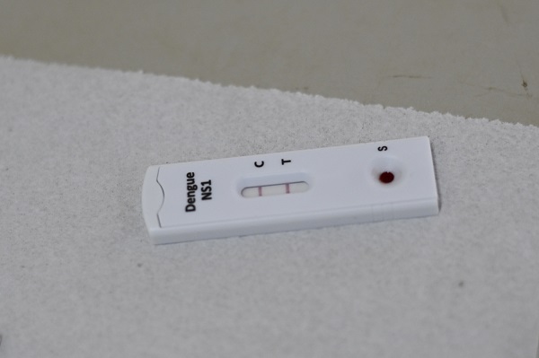 Foto - Brezilya’da salgın kabusu! 