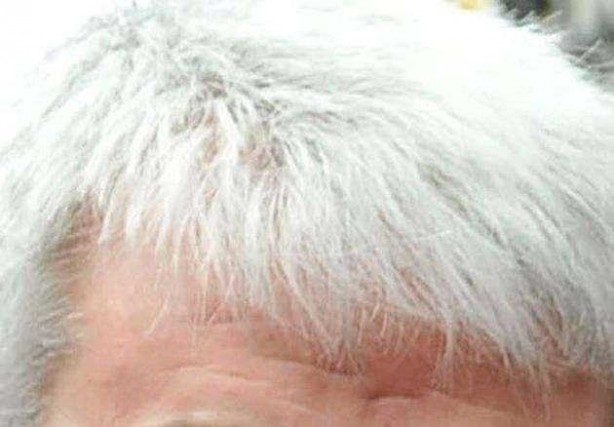 Foto - Bu 3 besini az tüketmek beyaz saçlara davetiye çıkarıyor