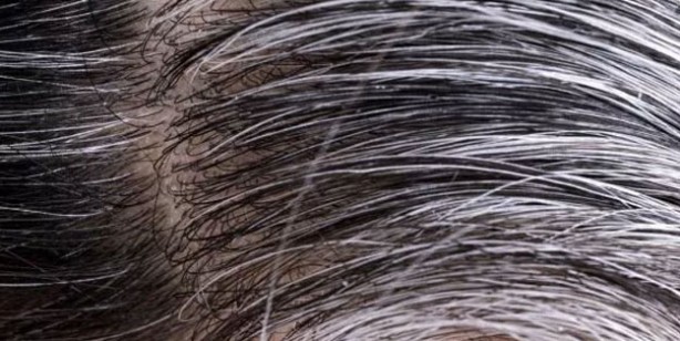 Foto - Bu 3 besini az tüketmek beyaz saçlara davetiye çıkarıyor