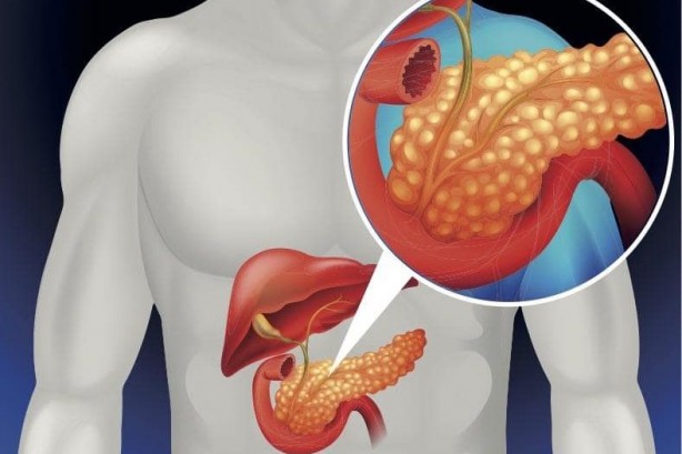 Foto - Bu 8 berti kanser habercisi olabilir